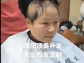 南阳女士假发补发